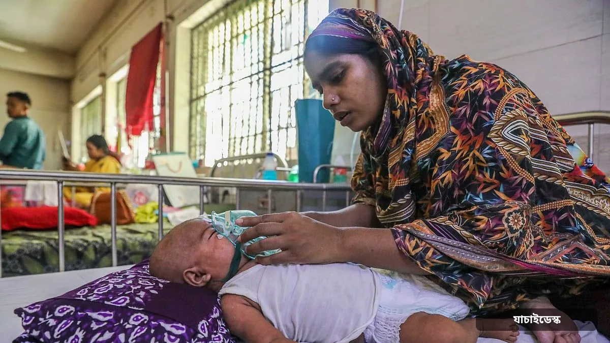 হামের উপসর্গে আরও ৬ মৃত্যু, মোট মৃত্যু ১,০৬৩